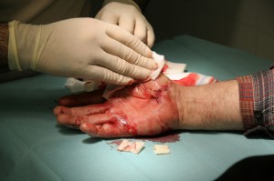 workplace workcover injury